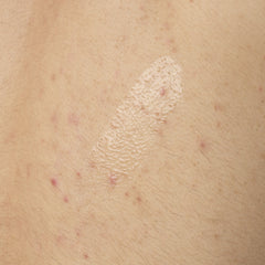 Salicylic Acid 0.5% Body Serum - Exfoliating & Blemish Treatment for Smooth Skin
